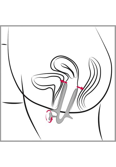 Vaginal Speculum